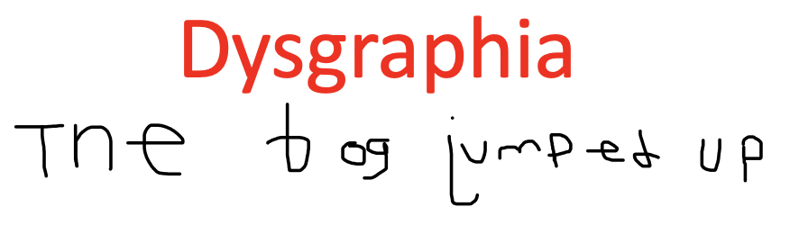 Dysgraphia Solutions – A Bottom Up Approach
